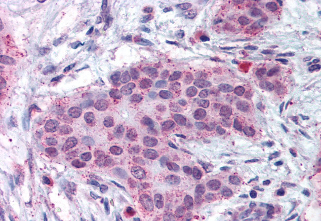 MMP13 Antibody in Immunohistochemistry (Paraffin) (IHC (P))