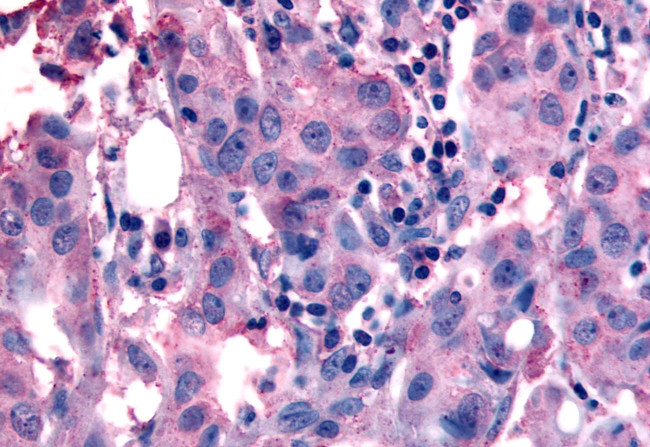 NANP Antibody in Immunohistochemistry (Paraffin) (IHC (P))