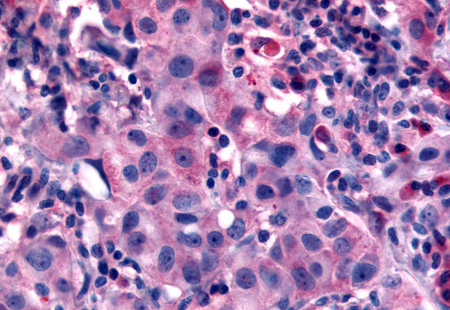 NANP Antibody in Immunohistochemistry (Paraffin) (IHC (P))