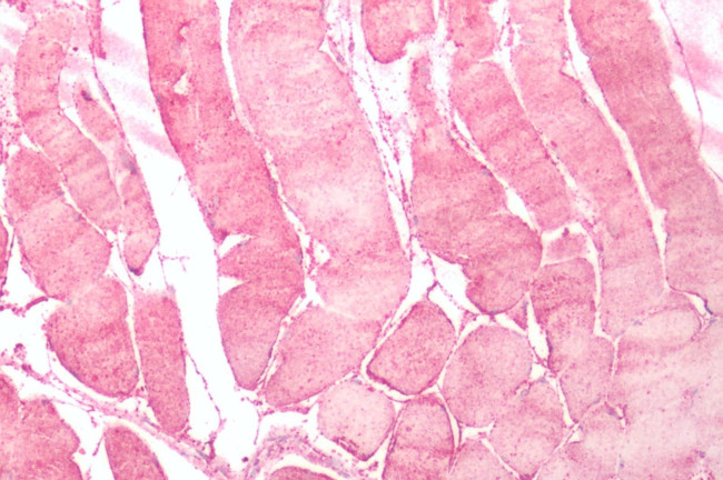 NMUR2 Antibody in Immunohistochemistry (Paraffin) (IHC (P))