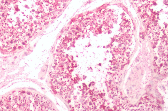 NMUR2 Antibody in Immunohistochemistry (Paraffin) (IHC (P))