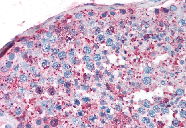 NR5A1 Antibody in Immunohistochemistry (Paraffin) (IHC (P))