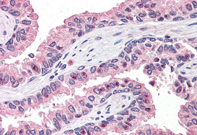 OLFM4 Antibody in Immunohistochemistry (Paraffin) (IHC (P))