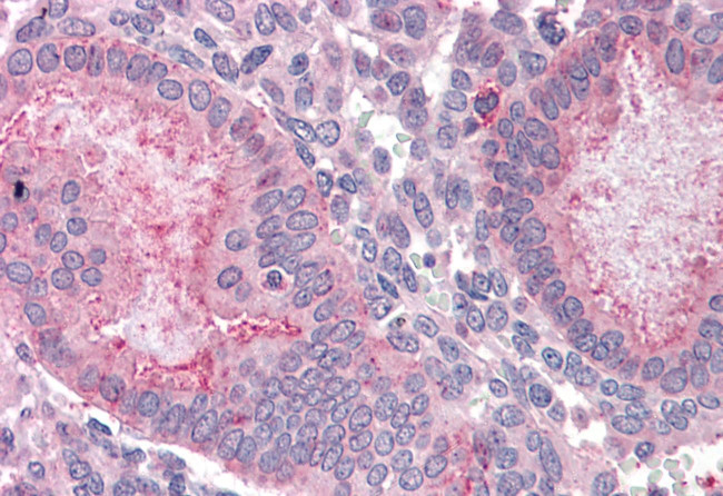 OLFM4 Antibody in Immunohistochemistry (Paraffin) (IHC (P))