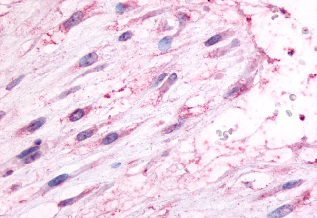 Oxytocin Receptor Antibody in Immunohistochemistry (Paraffin) (IHC (P))