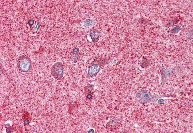 PAK7 Antibody in Immunohistochemistry (Paraffin) (IHC (P))