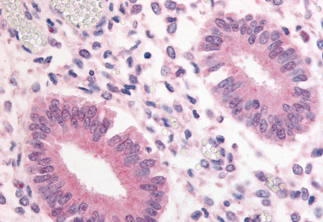 PDE3A Antibody in Immunohistochemistry (Paraffin) (IHC (P))