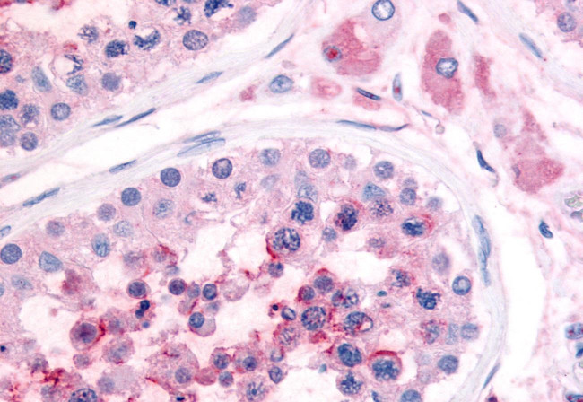 PDE3A Antibody in Immunohistochemistry (Paraffin) (IHC (P))