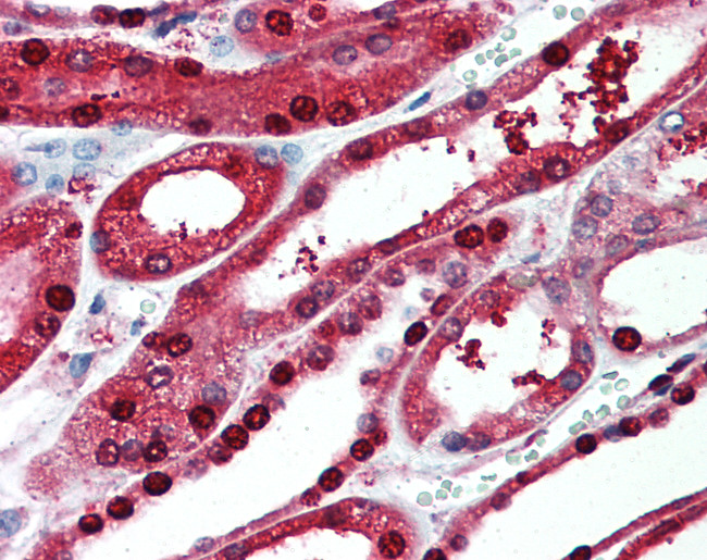 PIGR Antibody in Immunohistochemistry (Paraffin) (IHC (P))