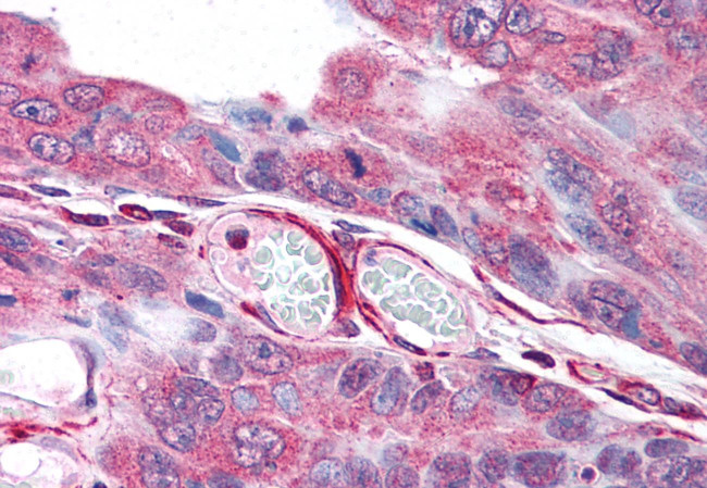 PLA2G3 Antibody in Immunohistochemistry (Paraffin) (IHC (P))