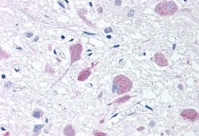 PLA2G3 Antibody in Immunohistochemistry (Paraffin) (IHC (P))