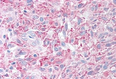 PLA2G3 Antibody in Immunohistochemistry (Paraffin) (IHC (P))