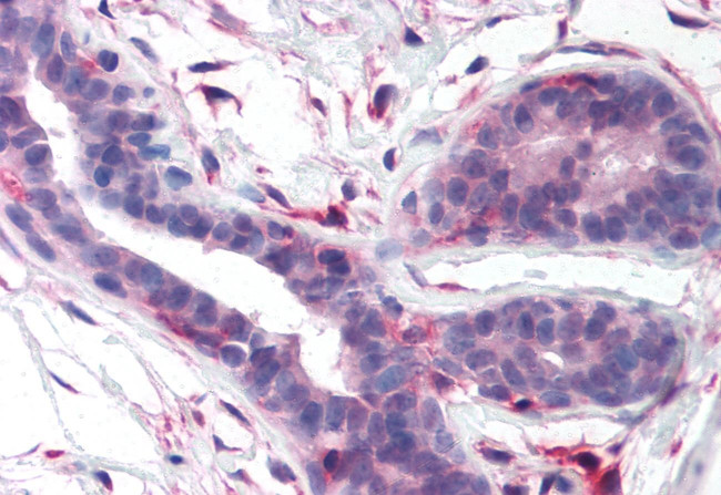 FAK Antibody in Immunohistochemistry (Paraffin) (IHC (P))