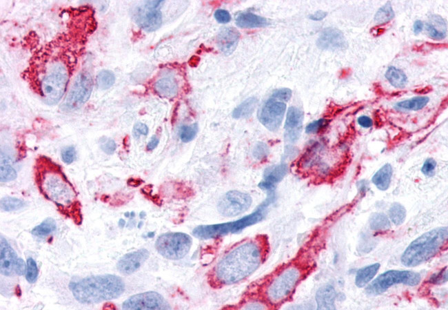 FAK Antibody in Immunohistochemistry (Paraffin) (IHC (P))