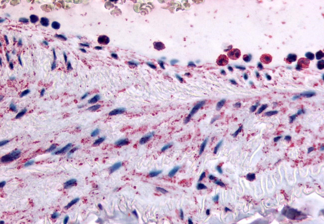 PTPMT1 Antibody in Immunohistochemistry (Paraffin) (IHC (P))