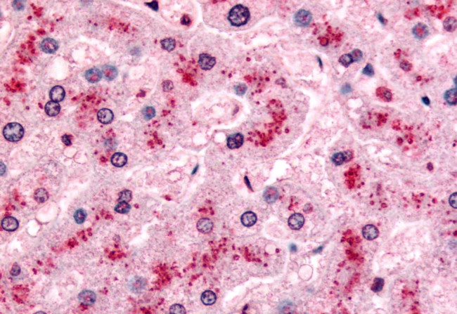 PYGL Antibody in Immunohistochemistry (Paraffin) (IHC (P))