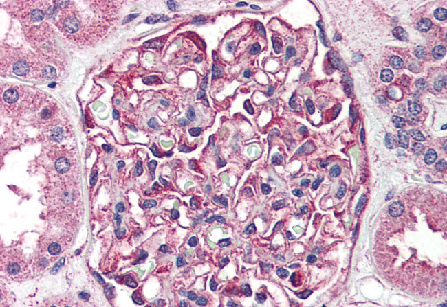 SGK2 Antibody in Immunohistochemistry (Paraffin) (IHC (P))