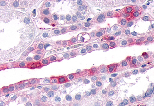 SGK3 Antibody in Immunohistochemistry (Paraffin) (IHC (P))