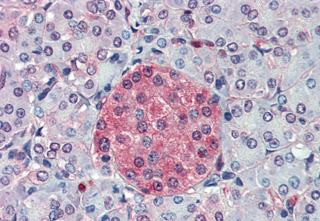 SLC11A2 Antibody in Immunohistochemistry (Paraffin) (IHC (P))