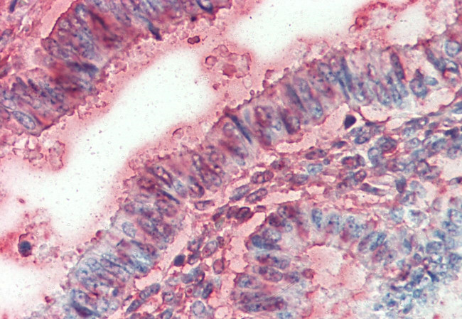 NKCC1 Antibody in Immunohistochemistry (Paraffin) (IHC (P))