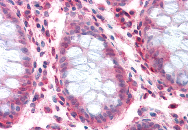 SLC1A4 Antibody in Immunohistochemistry (Paraffin) (IHC (P))