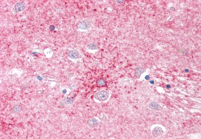 SLC1A4 Antibody in Immunohistochemistry (Paraffin) (IHC (P))