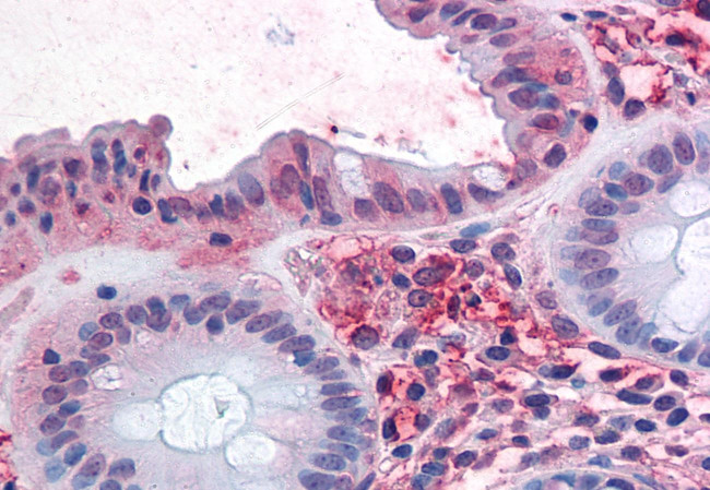 ASCT2 Antibody in Immunohistochemistry (Paraffin) (IHC (P))