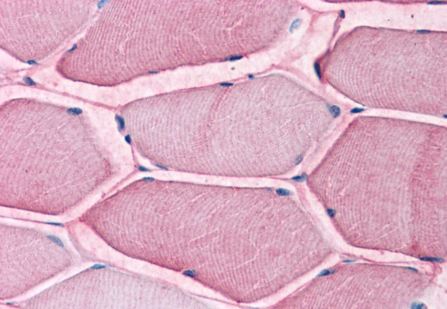 ASCT2 Antibody in Immunohistochemistry (Paraffin) (IHC (P))