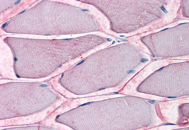 ASCT2 Antibody in Immunohistochemistry (Paraffin) (IHC (P))