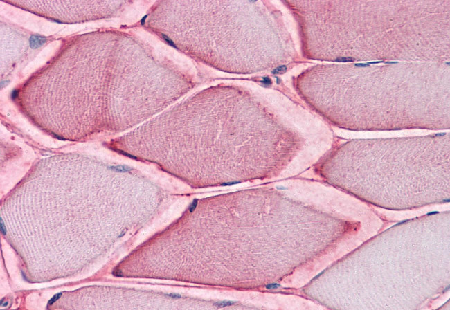 ASCT2 Antibody in Immunohistochemistry (Paraffin) (IHC (P))