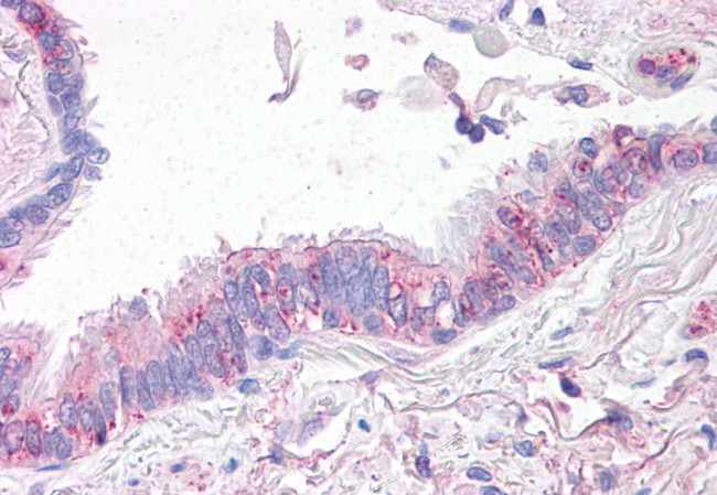 CTR1 Antibody in Immunohistochemistry (Paraffin) (IHC (P))