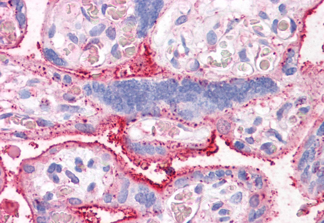 CTR1 Antibody in Immunohistochemistry (Paraffin) (IHC (P))