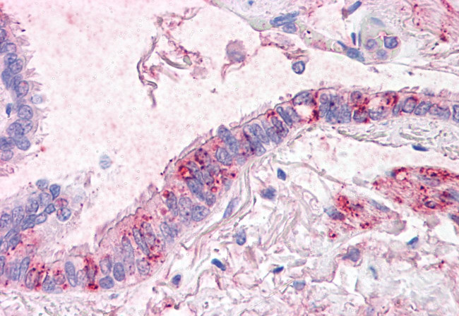 CTR1 Antibody in Immunohistochemistry (Paraffin) (IHC (P))