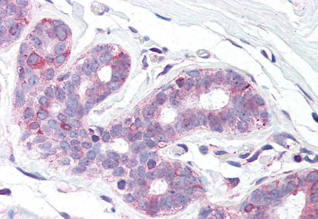 SLC39A6 Antibody in Immunohistochemistry (Paraffin) (IHC (P))