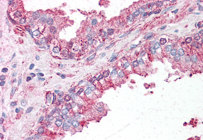 SLC39A6 Antibody in Immunohistochemistry (Paraffin) (IHC (P))