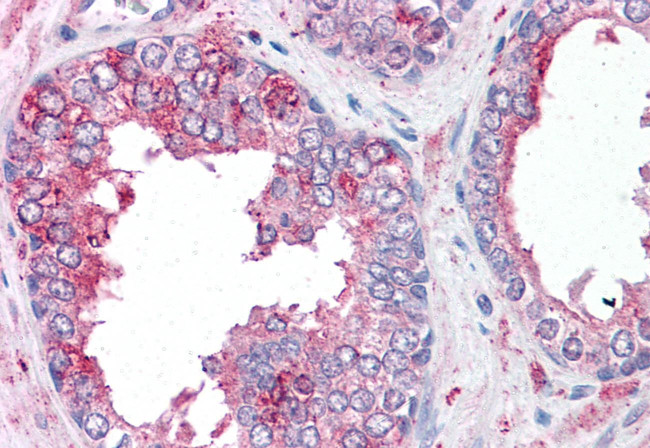 SLC39A6 Antibody in Immunohistochemistry (Paraffin) (IHC (P))