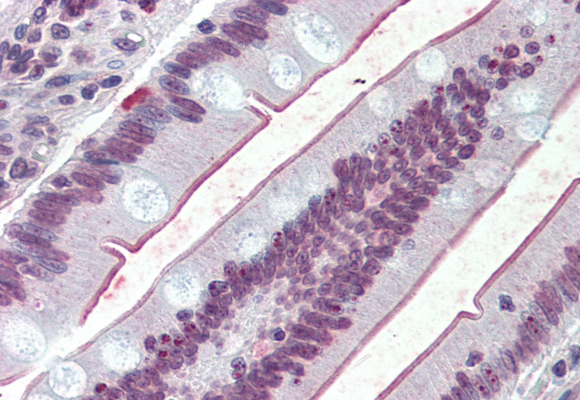 SGLT1 Antibody in Immunohistochemistry (Paraffin) (IHC (P))