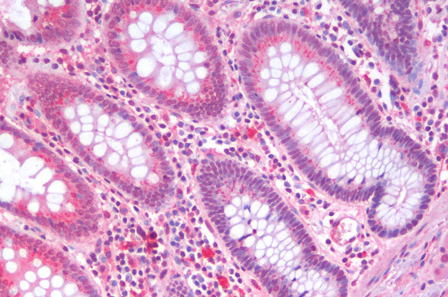 SLC5A4 Antibody in Immunohistochemistry (Paraffin) (IHC (P))