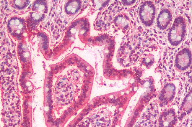 SLC5A4 Antibody in Immunohistochemistry (Paraffin) (IHC (P))