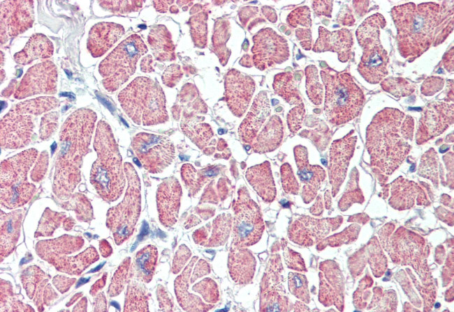 SLITRK6 Antibody in Immunohistochemistry (Paraffin) (IHC (P))