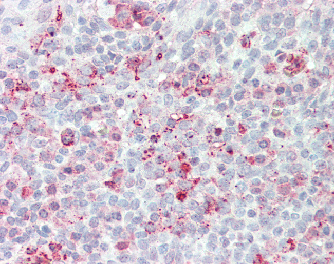 STEAP2 Antibody in Immunohistochemistry (Paraffin) (IHC (P))