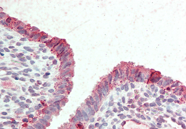 STEAP2 Antibody in Immunohistochemistry (Paraffin) (IHC (P))