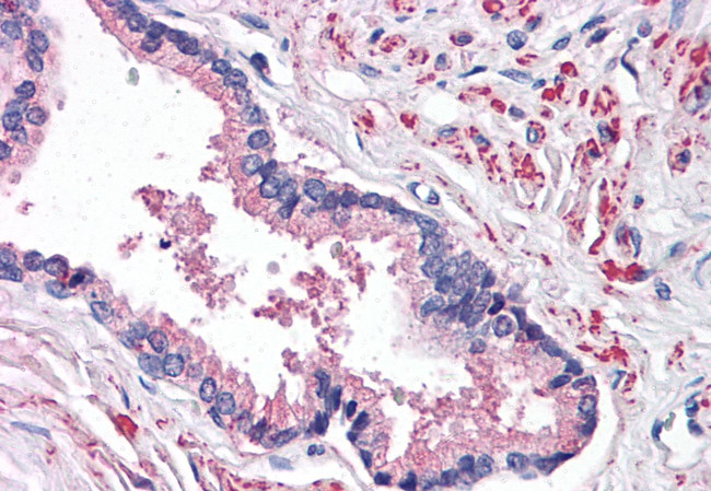 STEAP2 Antibody in Immunohistochemistry (Paraffin) (IHC (P))