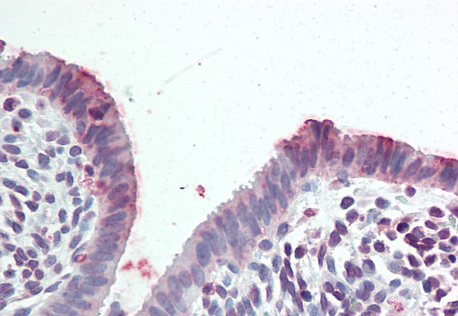 STEAP2 Antibody in Immunohistochemistry (Paraffin) (IHC (P))