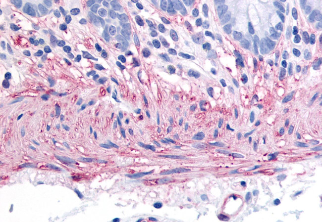 TACR2 Antibody in Immunohistochemistry (Paraffin) (IHC (P))