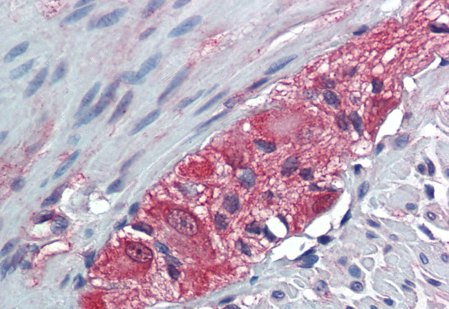 TXLNB Antibody in Immunohistochemistry (Paraffin) (IHC (P))