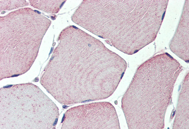 TXLNB Antibody in Immunohistochemistry (Paraffin) (IHC (P))