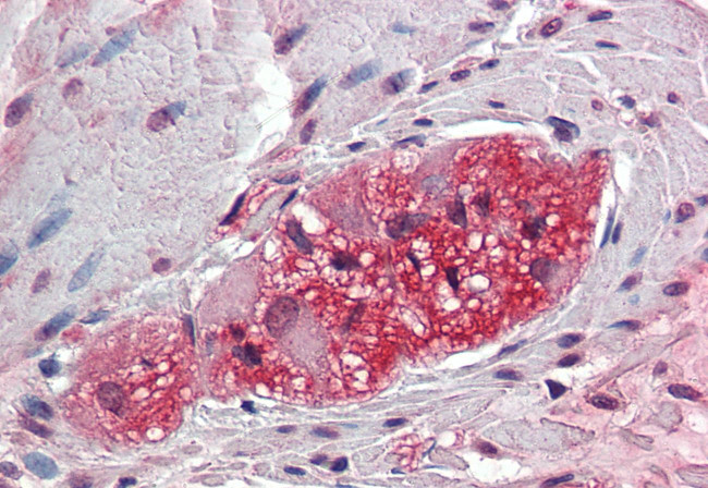 TXLNB Antibody in Immunohistochemistry (Paraffin) (IHC (P))