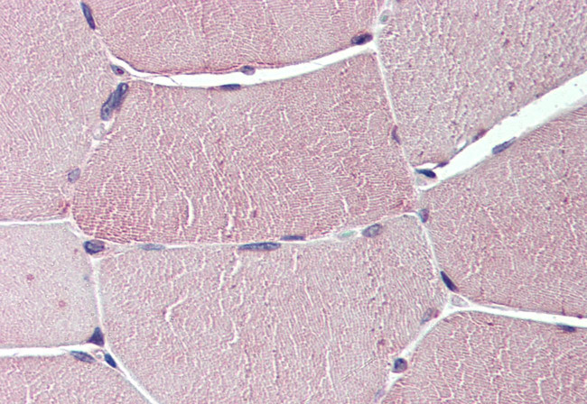 TXLNB Antibody in Immunohistochemistry (Paraffin) (IHC (P))