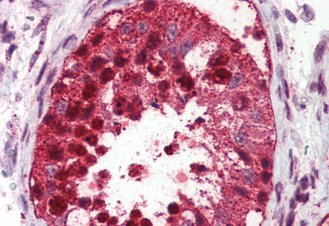 USP2 Antibody in Immunohistochemistry (Paraffin) (IHC (P))